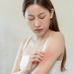 揭秘！“马来西亚皮肤护理中心”TOP 5：你的肌肤新生之旅从这里开始！